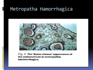 Metropatha Hamorrhagica
 