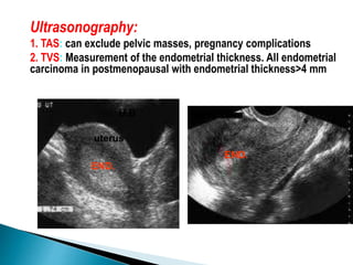 Ultrasonography:
1. TAS: can exclude pelvic masses, pregnancy complications
2. TVS: Measurement of the endometrial thickness. All endometrial
carcinoma in postmenopausal with endometrial thickness>4 mm
uterus
END.
U.B
END.
 