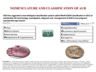 NOMENCLATURE AND CLASSIFICATION OF AUB
FIGO has suggested a new etiological classification system called PALM-COEIN classification in 2011 to
standardize the terminology, investigation, diagnosis and management of AUB in non pregnant
reproductive age women
 