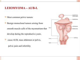 LEIOMYOMA – AUB-L
 Most common pelvic tumors
 Benign monoclonal tumors arising from
smooth muscle cells of the myometrium that
develop during the reproductive years.
 cause AUB, mass abdomen or pelvis,
pelvic pain and infertility
 
