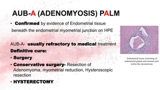 AUB-A (ADENOMYOSIS) PALM
• Confirmed by evidence of Endometrial tissue
beneath the endometrial myometrial junction on HPE
AUB-A- usually refractory to medical treatment
Definitive cure:
• Surgery
• Conservative surgery- Resection of
Adenomyoma, myometrial reduction, Hysteroscopic
resection
• HYSTERECTOMY
Endometrial tissue consisting of
endometrial glands and stromal cells
within the myometrium
 