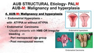 AUB STRUCTURAL Etiology- PALM
AUB-M: Malignancy and hyperplasia
4. AUB-M: Malignancy and hyperplasia
• Endometrial Hyperplasia –
with ATYPIA or without ATYPIA
• Endometrial Carcinoma
-Usually presents with HMB OR Irregular
bleeding -in
- Peri menopausal age group
- Post menopausal women
Endometrial hyperplasia
Endometrial Carcinoma
 