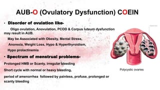 AUB-O (Ovulatory Dysfunction) COEIN
• Disorder of ovulation like-
Oligo ovulation, Anovulation, PCOD & Corpus luteum dysfunction
may result in AUB.
May be Associated with Obesity, Mental Stress,
Anorexia, Weight Loss, Hypo & Hyperthyroidism,
Hypo prolactinemia
• Spectrum of menstrual problems-
Prolonged HMB or Scanty, irregular bleeding
Short cycle with normal or heavy bleeding,
period of amenorrhea followed by painless, profuse, prolonged or
scanty bleeding
Polycystic ovaries
 