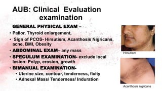GENERAL PHYSICAL EXAM –
• Pallor, Thyroid enlargement,
• Sign of PCOS- Hirsutism, Acanthosis Nigricans,
acne, BMI, Obesity
• ABDOMINAL EXAM– any mass
• SPECULUM EXAMINATION- exclude local
lesion: Polyp, erosion, growth
• BIMANUAL EXAMINATION-
• Uterine size, contour, tenderness, fixity
• Adnexal Mass/ Tenderness/ Induration
AUB: Clinical Evaluation
examination
Acanthosis nigricans
Hirsutism
 