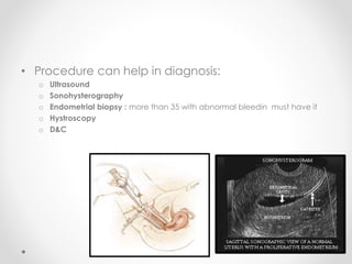 • Procedure can help in diagnosis:
o Ultrasound
o Sonohysterography
o Endometrial biopsy : more than 35 with abnormal bleedin must have it
o Hystroscopy
o D&C
 