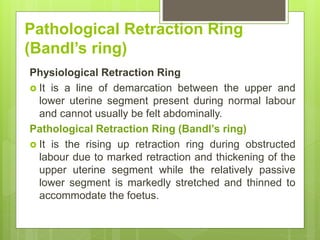 Pathological Retraction Ring
(Bandl’s ring)
Physiological Retraction Ring
 It is a line of demarcation between the upper and
lower uterine segment present during normal labour
and cannot usually be felt abdominally.
Pathological Retraction Ring (Bandl’s ring)
 It is the rising up retraction ring during obstructed
labour due to marked retraction and thickening of the
upper uterine segment while the relatively passive
lower segment is markedly stretched and thinned to
accommodate the foetus.
 