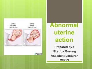 Abnormal
uterine
action
Prepared by :
Nirsuba Gurung
Assistant Lecturer
MSON
 