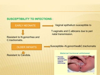 SUSCEPTIBILITY TO INFECTIONS :
EARLY NEONATE Vaginal epithelium susceptible to
T.vaginalis and C.albicans due to peri
natal transmission.
Resistant to N.gonorrhea and
C.trachomatis.
OLDER INFANTS Susceptible--N.gonorrhea&C.trachomatis
Resistant to Candida.
EARLY NEONATE
OLDER INFANTS
 