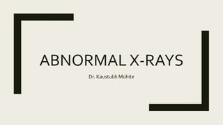 ABNORMAL X-RAYS
Dr. Kaustubh Mohite
 