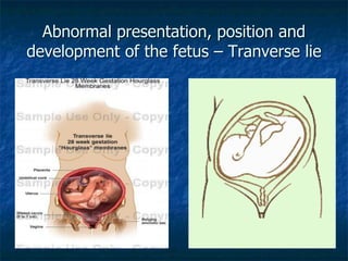 Abnormalities of labour and delivery | PDF