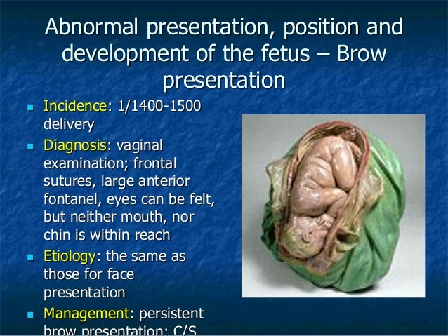 Face presentation causes image