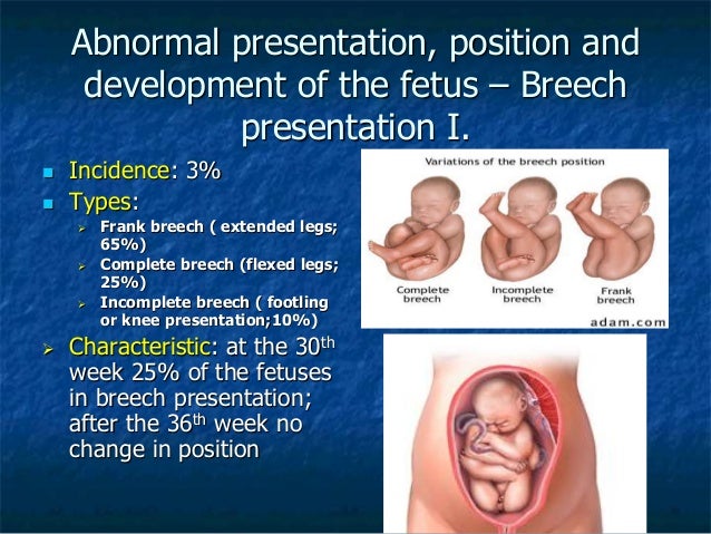 abnormal presentation of fetus slideshare