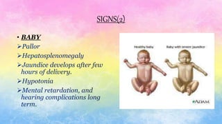 SIGNS(2)
• BABY