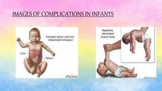 IMAGES OF COMPLICATIONS IN INFANTS