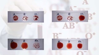 ABO blood.pptx