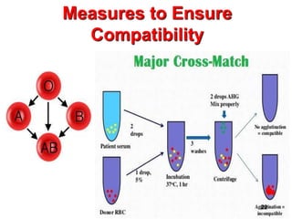 ABO Blood group by Dr. Aryan | PPTX