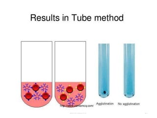 Abo blood group system | PPTX