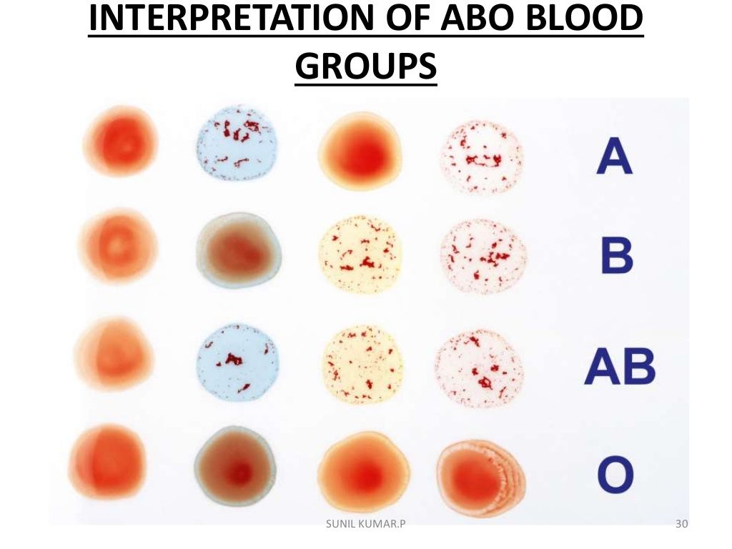 Abo blood group system