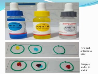 First add
antisera to
slide
Samples
added to
slides
 
