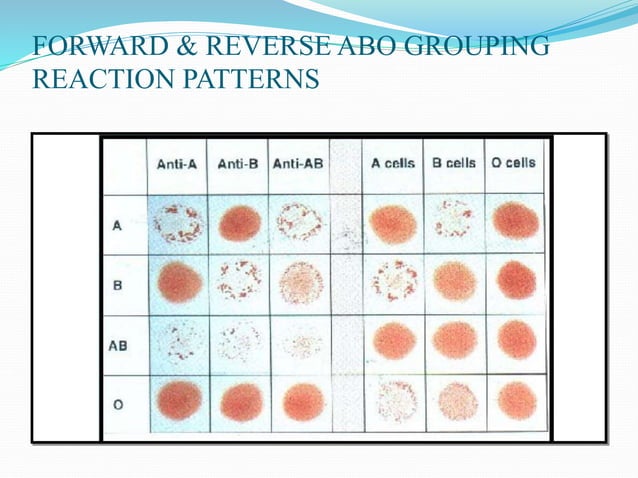 ABO Blood Group System.pptx | Blood Disorders | Diseases and Conditions