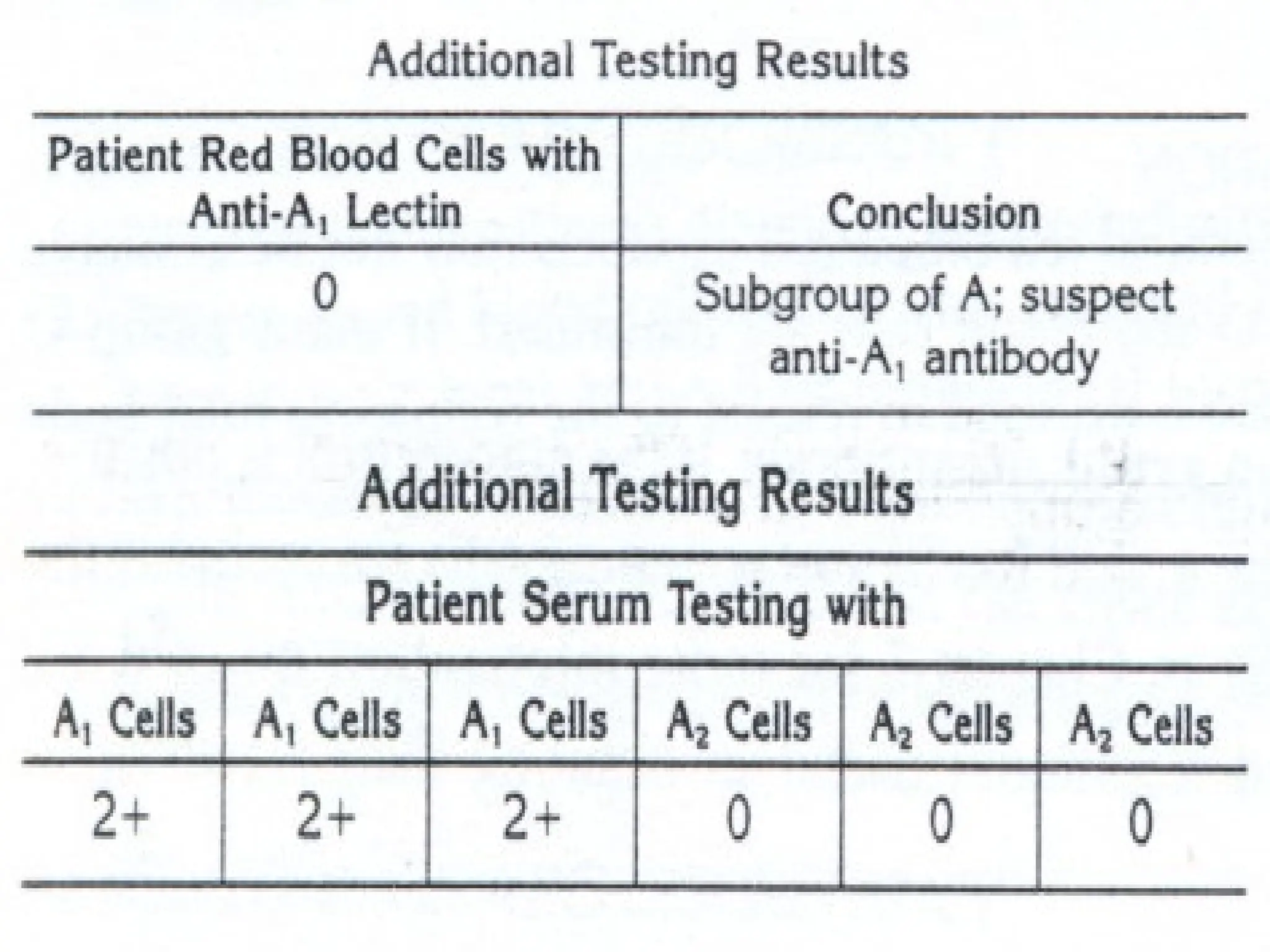 ABO_BLOOD_GROUP_SYSTEM-short.pptx describe how to mesure ABO Blood ...