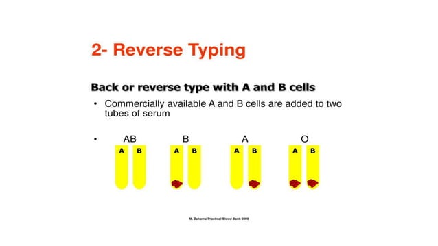 Abo DISCREPANCIES blood bank abo system.pptx