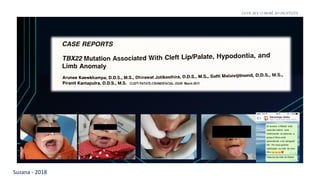 Suzana - 2018
LEVE SEU O BEBÊ AO DENTISTA
 