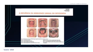 Suzana - 2018
LEVE SEU O BEBÊ AO DENTISTA
 