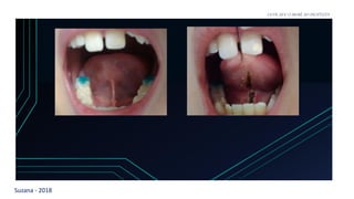 Suzana - 2018
LEVE SEU O BEBÊ AO DENTISTA
 