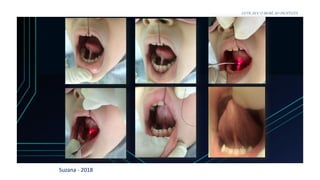 Suzana - 2018
LEVE SEU O BEBÊ AO DENTISTA
SCM
 