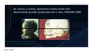 Suzana - 2018
LEVE SEU O BEBÊ AO DENTISTA
NAHAS
Ao nascer, a criança apresenta o crânio muito mais
desenvolvido quando comparado com a face. PINKHAN-1996
 