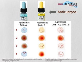 http://www.joaquinrodriguezpiaya.es/Informaciongeneral/Olimpiadas/
Fotos/grupos_sanguineos.JPG	
  
http://dimequiensoy.wikispaces.com/ﬁle/view/soros.gif/
135213455/315x308/soros.gif	
  
Anticuerpos	
  
 