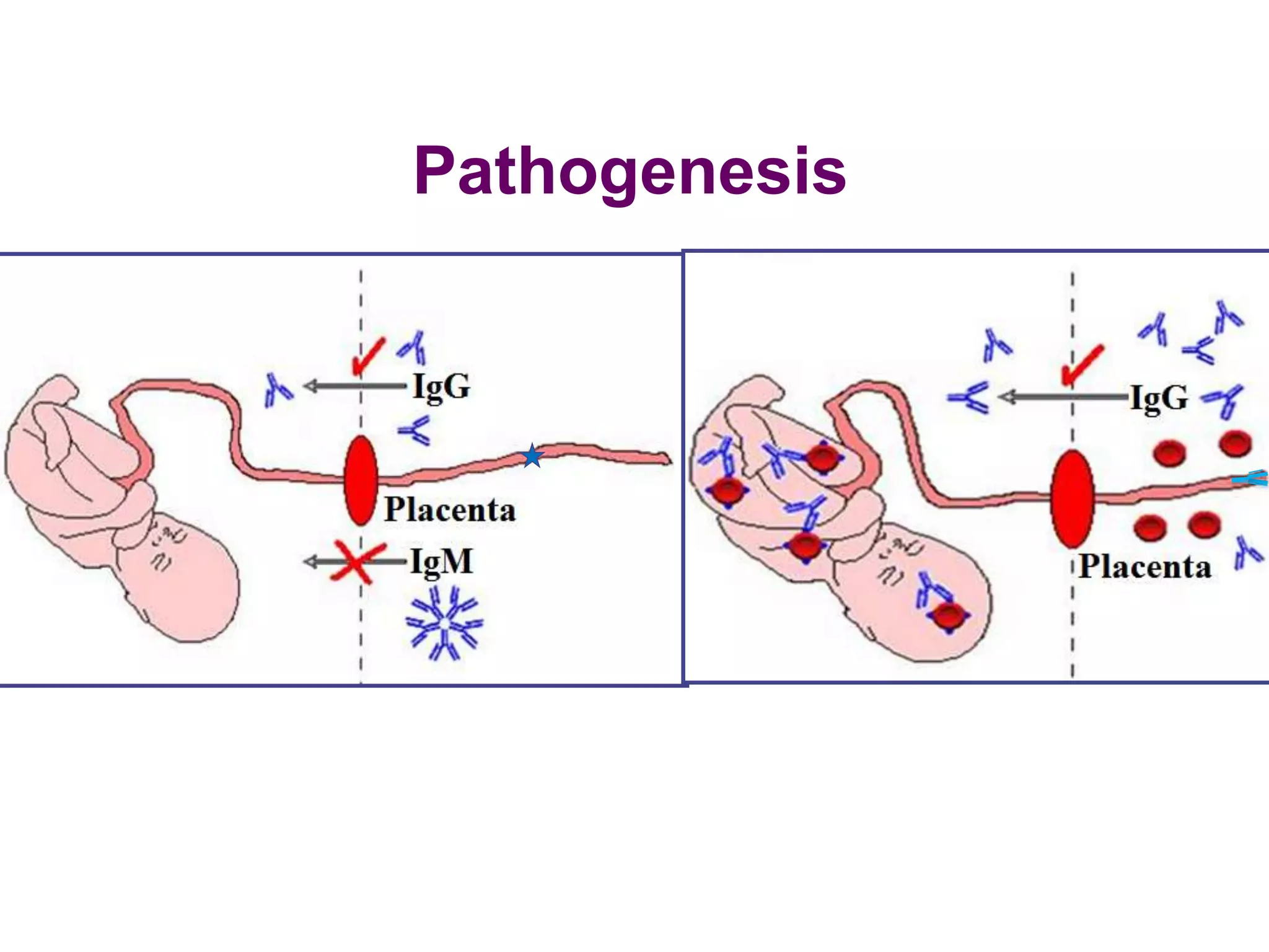 Pathogenesis
 