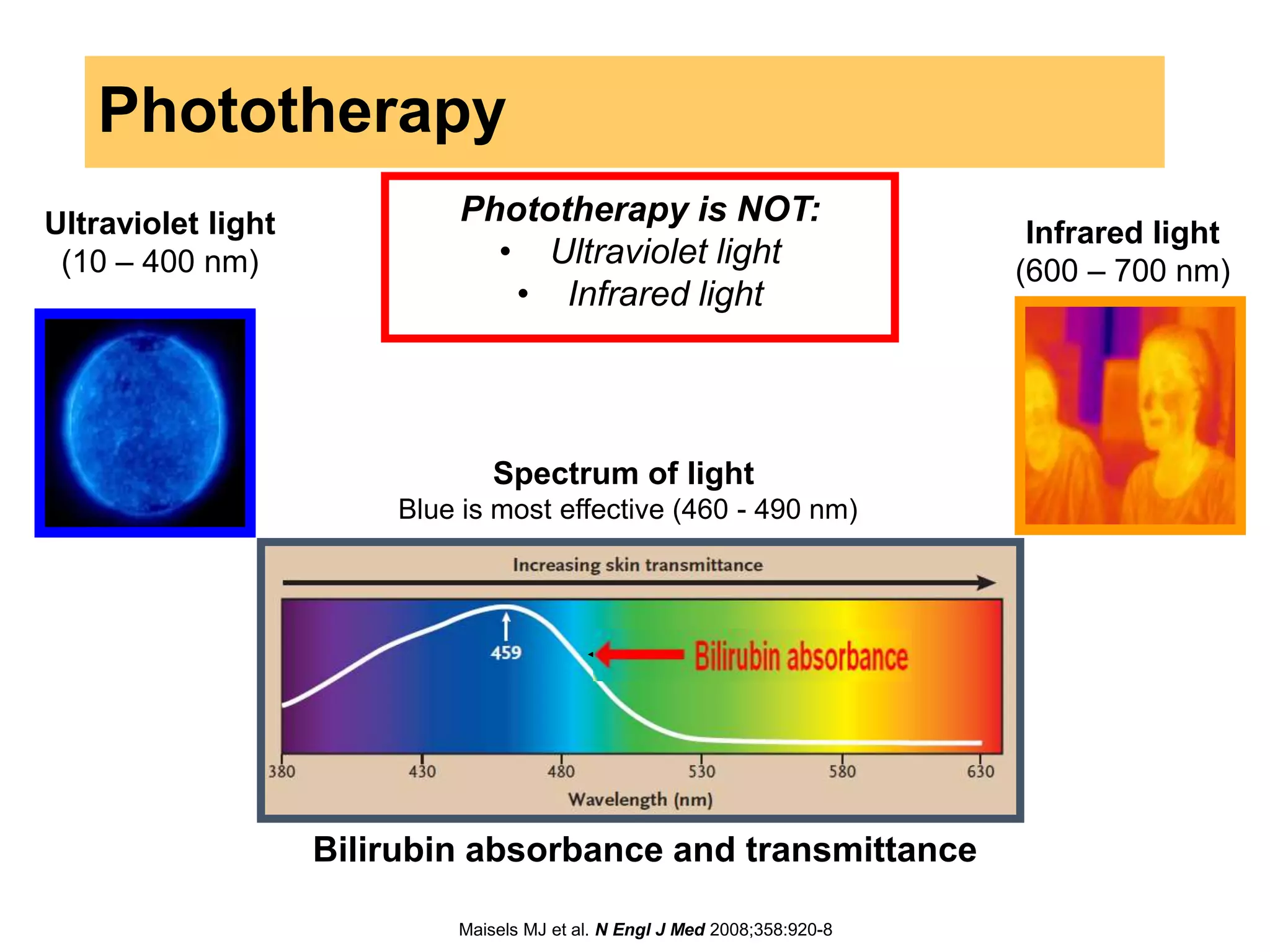 Phototherapy
Spectrum of light
Blue is most effective (460 - 490 nm)
Ultraviolet light
(10 – 400 nm)
Infrared light
(600 – 700 nm)
Phototherapy is NOT:
• Ultraviolet light
• Infrared light
Bilirubin absorbance and transmittance
Maisels MJ et al. N Engl J Med 2008;358:920-8
Bilirubin absorbance
 