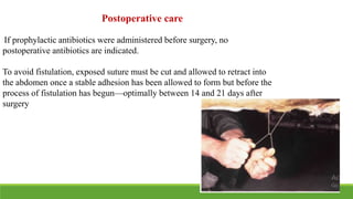 If prophylactic antibiotics were administered before surgery, no
postoperative antibiotics are indicated.
To avoid fistulation, exposed suture must be cut and allowed to retract into
the abdomen once a stable adhesion has been allowed to form but before the
process of fistulation has begun—optimally between 14 and 21 days after
surgery
Postoperative care
 