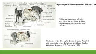 Illustration by Dr. Gheorghe Constantinescu. Adapted,
with permission, from DeLahunta and Habel, Applied
Veterinary Anatomy, W.B. Saunders, 1986.
Right displaced abomasum with volvulus, cow
A) Normal topography of right
abdominal viscera, cow. B) Right
displacement of abomasum with
volvulus.
 
