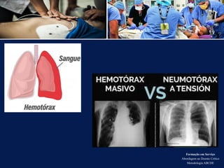 Formação em Serviço
Abordagem ao Doente Crítico
Metodologia ABCDE
 