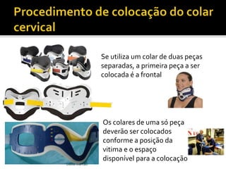Dalila Marcão 
Se utiliza um colar de duas peças 
separadas, a primeira peça a ser 
colocada é a frontal 
Os colares de uma só peça 
deverão ser colocados 
conforme a posição da 
vitima e o espaço 
disponível para a colocação 
 