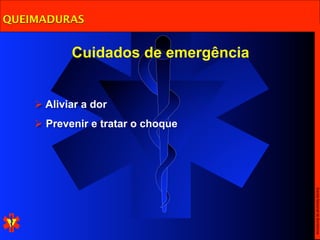 QUEIMADURAS


           Cuidados de emergência


     Aliviar a dor
     Prevenir e tratar o choque




                                    Escola Nacional de Bombeiros
 