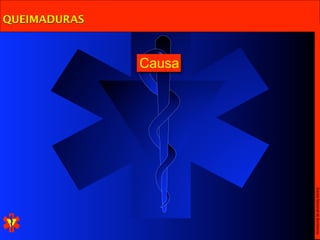 Escola Nacional de Bombeiros
              Causa
QUEIMADURAS
 