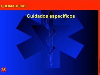 QUEIMADURAS


              Cuidados específicos




                                     Escola Nacional de Bombeiros
 