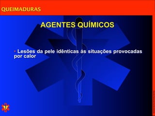 QUEIMADURAS


             AGENTES QUÍMICOS


   • Lesões da pele idênticas ás situações provocadas
   por calor




                                                        Escola Nacional de Bombeiros
 