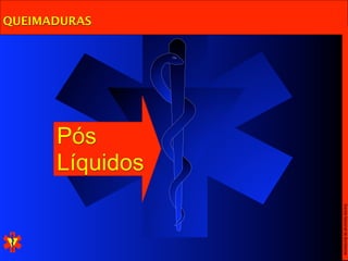 Escola Nacional de Bombeiros
              Líquidos
              Pós
QUEIMADURAS
 