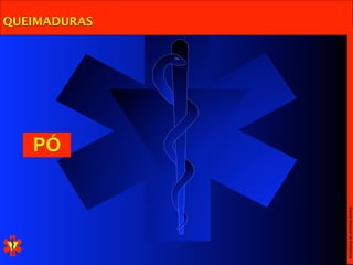 Escola Nacional de Bombeiros
QUEIMADURAS




              PÓ
 