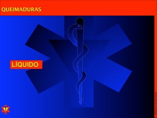 Escola Nacional de Bombeiros
QUEIMADURAS




              LÍQUIDO
 