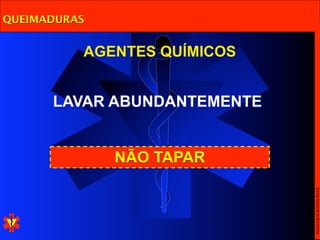 QUEIMADURAS


          AGENTES QUÍMICOS


      LAVAR ABUNDANTEMENTE


              NÃO TAPAR




                             Escola Nacional de Bombeiros
 