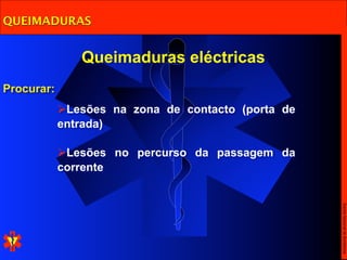 QUEIMADURAS


               Queimaduras eléctricas
Procurar:
            Lesões na zona de contacto (porta de
            entrada)

            Lesões no percurso da passagem da
            corrente




                                                    Escola Nacional de Bombeiros
 