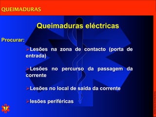 QUEIMADURAS


                Queimaduras eléctricas
Procurar:
            Lesões na zona de contacto (porta de
            entrada)

            Lesões no percurso da passagem da
            corrente

            Lesões no local de saída da corrente




                                                    Escola Nacional de Bombeiros
            lesões periféricas
 
