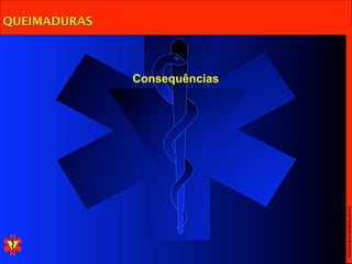 Escola Nacional de Bombeiros
              Consequências
QUEIMADURAS
 