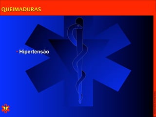 Escola Nacional de Bombeiros
              • Hipertensão
QUEIMADURAS
 